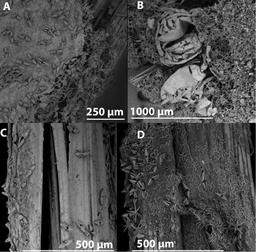 abyssocladia oxyasters microscope