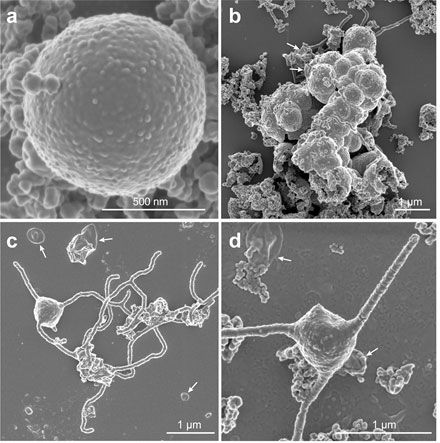 bacterie tentacules secrets origined vie complexe MEB