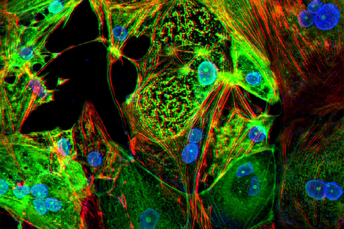 cellules cardiques infectees sars-cov-2