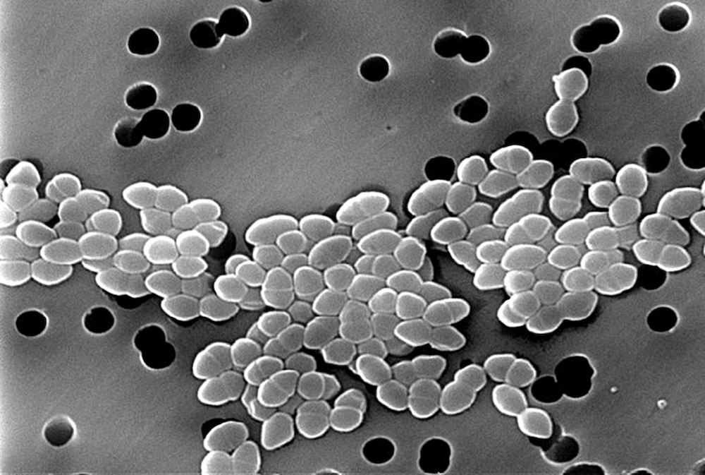 enterocoque resistant vancomycine