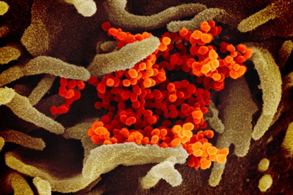sars cov 2 coronavirus covid-19