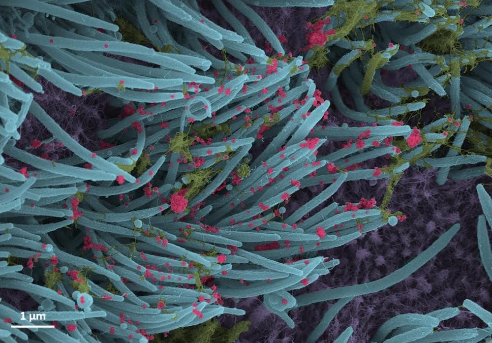 structure densite virions sars-cov-2