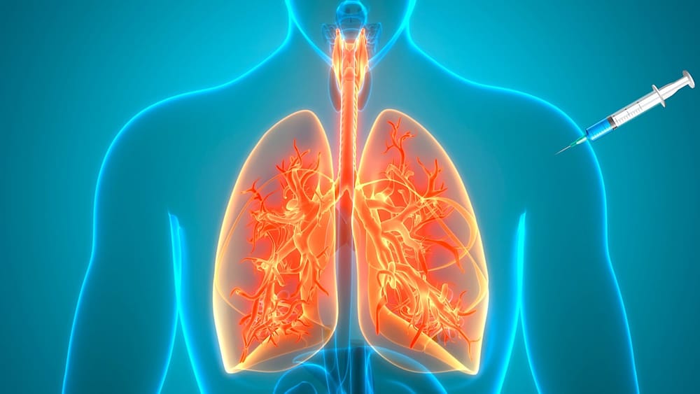 Un vaccin contre l'asthme développé par l'INSERM