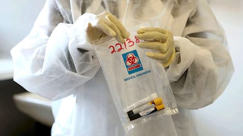 COVID : une nouvelle variante avec des "mutations potentiellement inquiétantes" découverte au Royaume-Uni